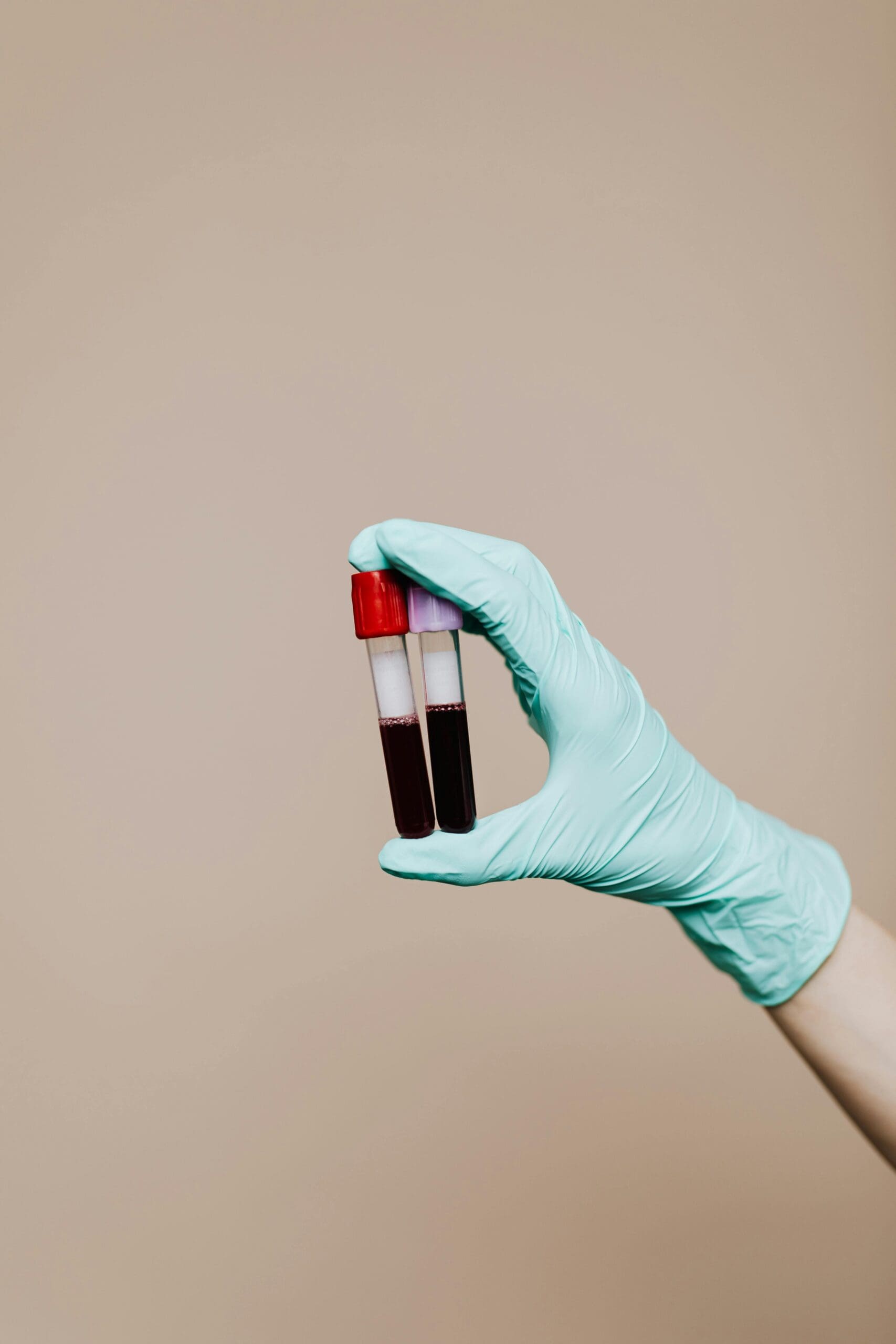 Medical professional in teal latex gloves holding two blood collection tubes with dark red blood samples - one with red cap and one with lavender cap. Blood test vials displayed against neutral beige background. Essential component of comprehensive health screening for fitness and performance biomarker tracking.
