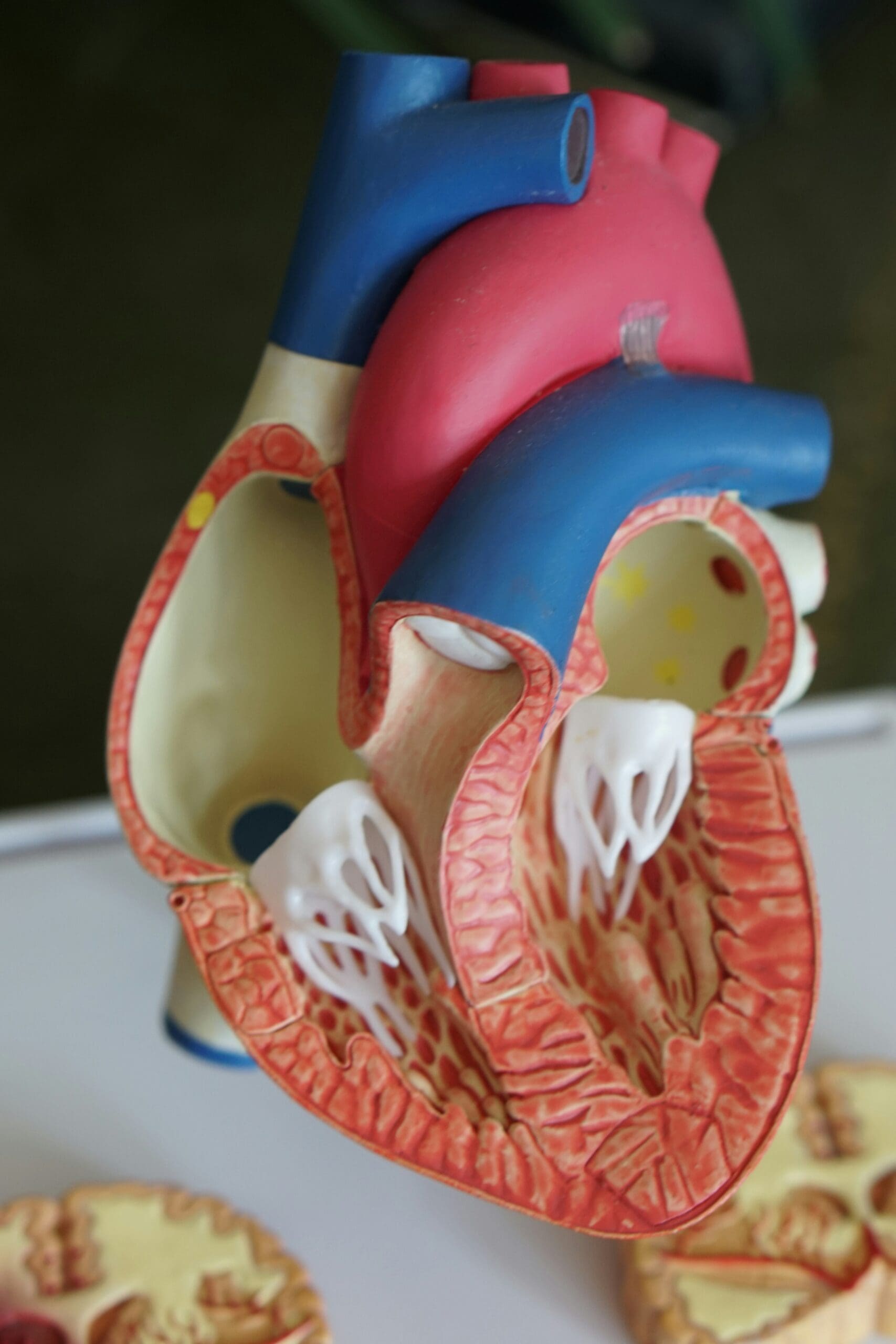 Cross-section anatomical heart model showing internal cardiac chambers and coronary arteries where calcium score testing measures plaque buildup