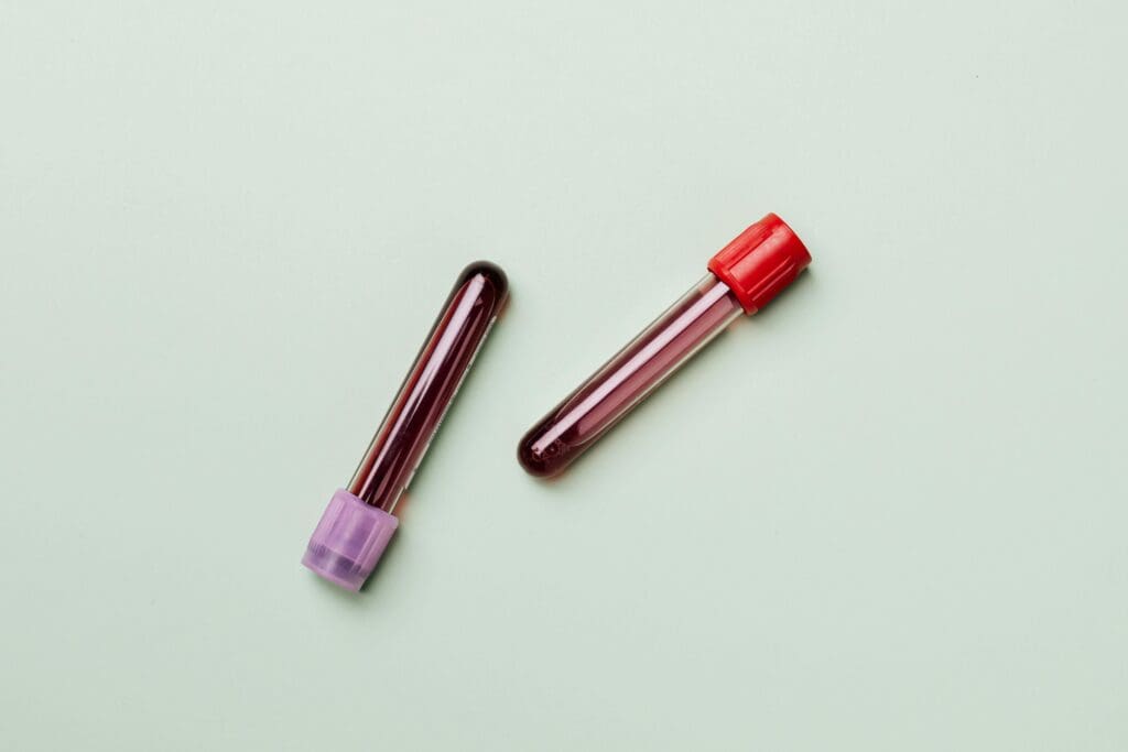 Two blood test tubes with purple and red caps on white background for 25-hydroxyvitamin D blood testing