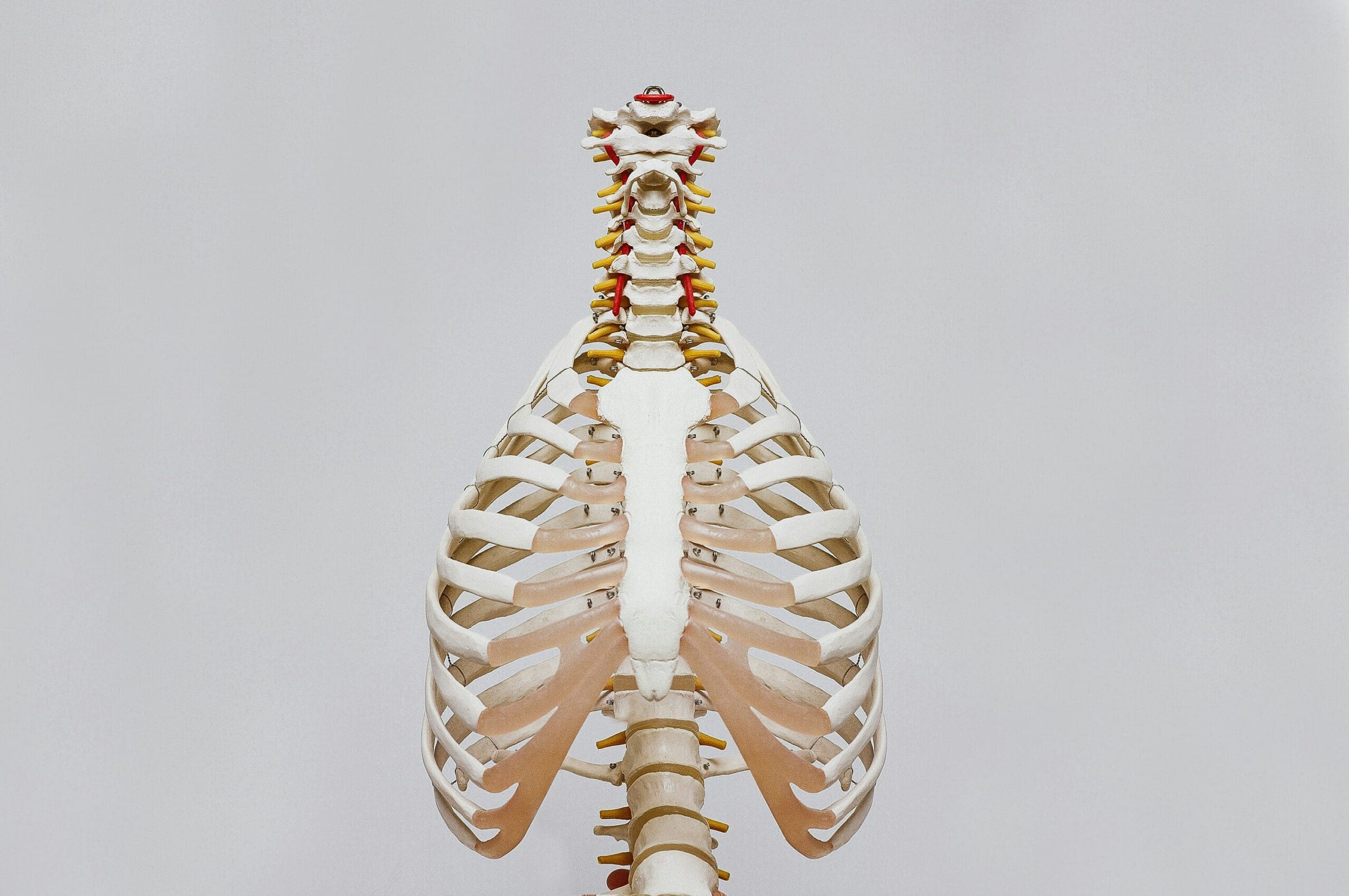 3D anatomical model of human ribcage and spine showing bone structure relevant to osteoporosis and bone density