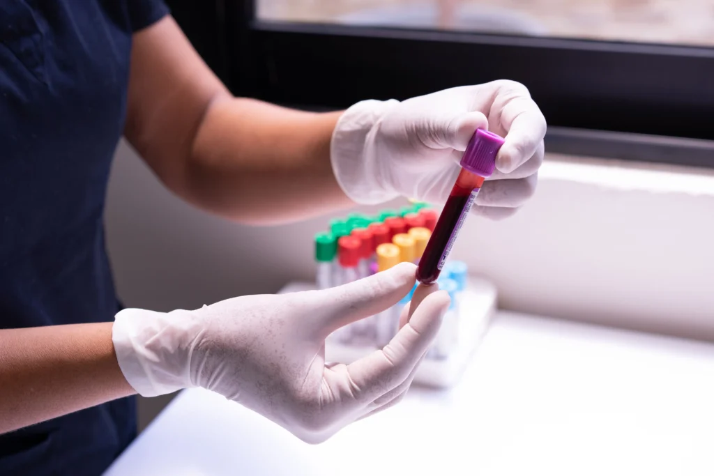 Gloved hands holding a blood collection tube filled with a dark red sample, with a rack of color-capped tubes on the counter behind